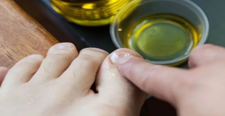 Essential oils to combat mushrooms