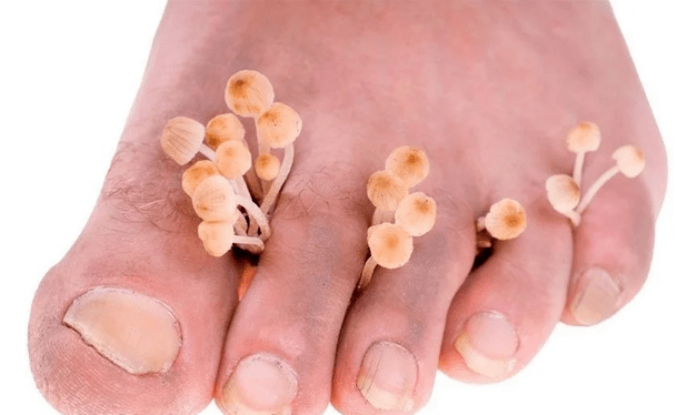 Skin mushroom