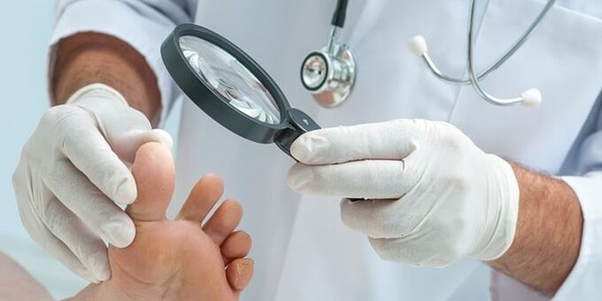 The doctor examined the foot infected with a mushroom
