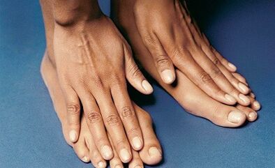 How to treat a mushroom on your fingers