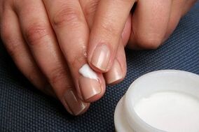 Treatment of nail fungus with ointment